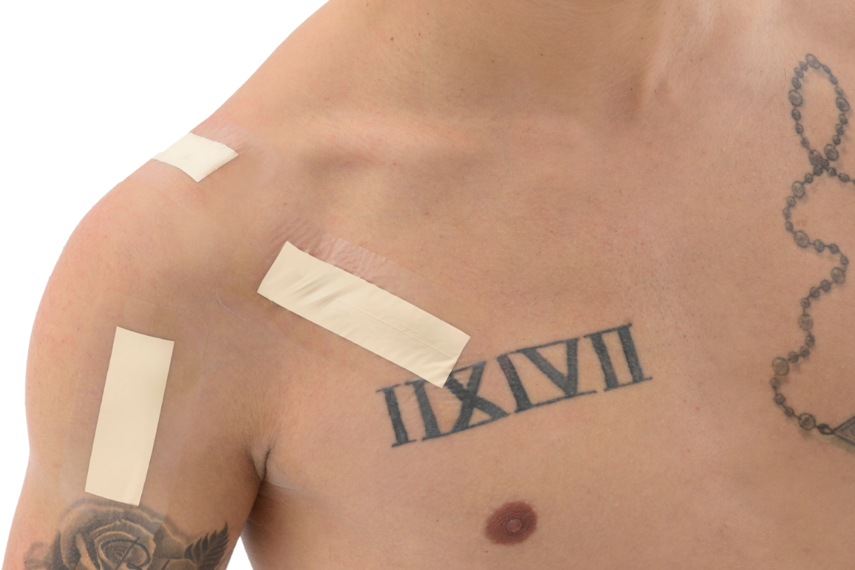 Sanotape® Narbenpflaster 5x12cm | OP-Narben & Dekubitus-Prophylaxe