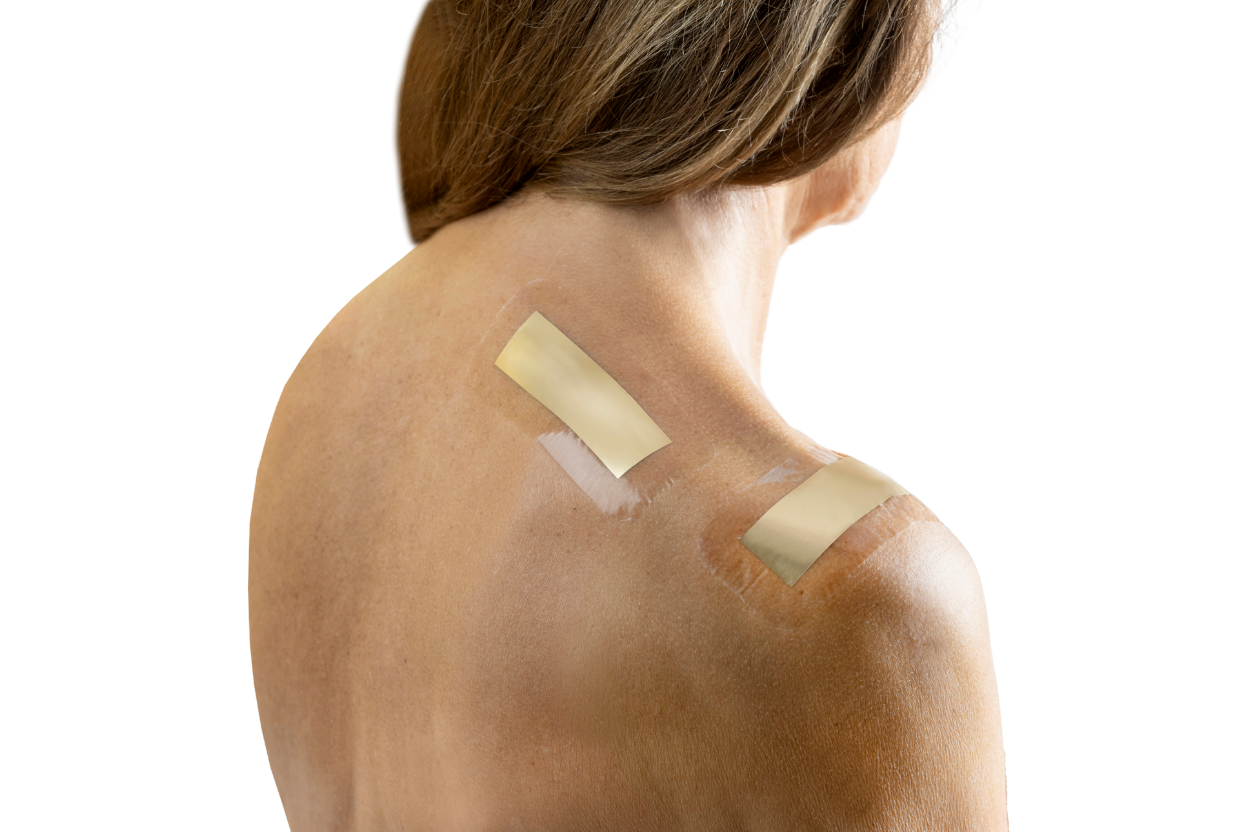 Sanotape® Narbenpflaster 5x12cm | OP-Narben & Dekubitus-Prophylaxe